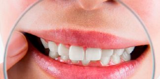 5 facilidades que você terá com um plano dental