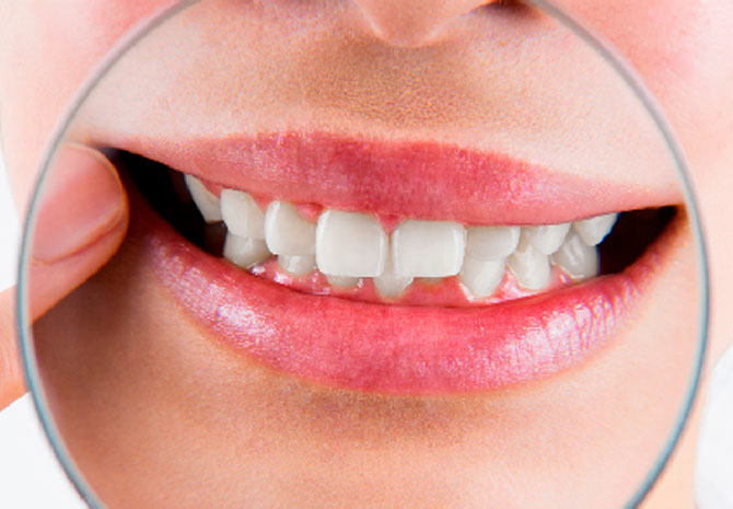 5 facilidades que você terá com um plano dental