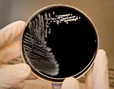 Placa de Petri com Legionella