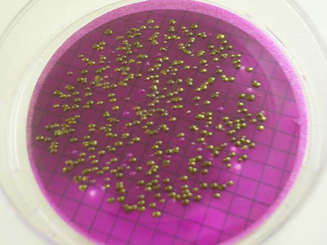 Detecção de Escherichia coli
