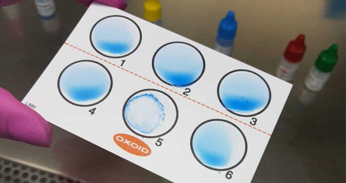 Como funciona a identificação de sorotipos de Legionella? Como funciona a identificação de sorotipos de Legionella?